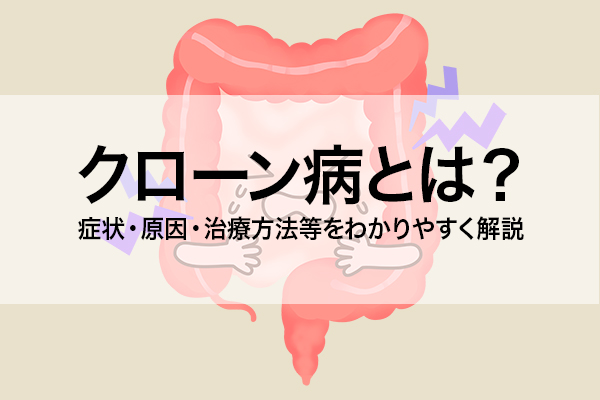 クローン病とは？ 症状・原因・治療方法等をわかりやすく解説