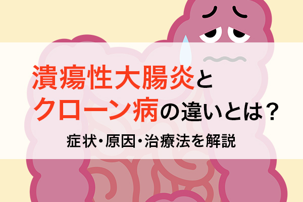 潰瘍性大腸炎とクローン病の違いとは？症状・原因・治療法を解説