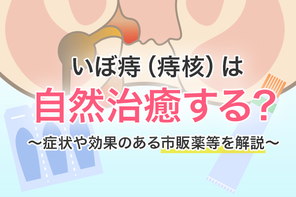 いぼ痔 （痔核）は自然治癒する？症状や効果のある市販薬等を解説