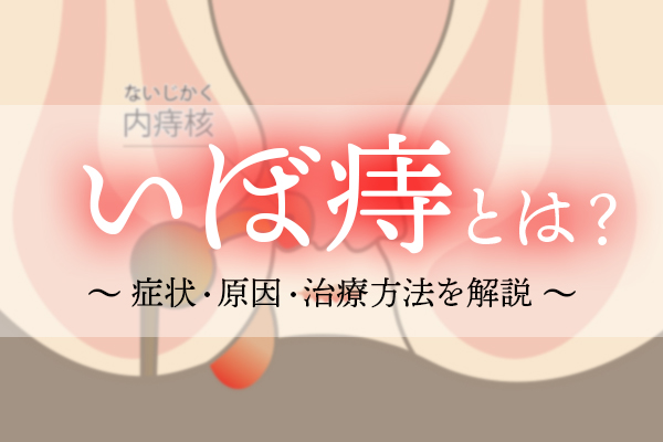 いぼ痔（内痔核）とは？症状・原因・治療方法を解説